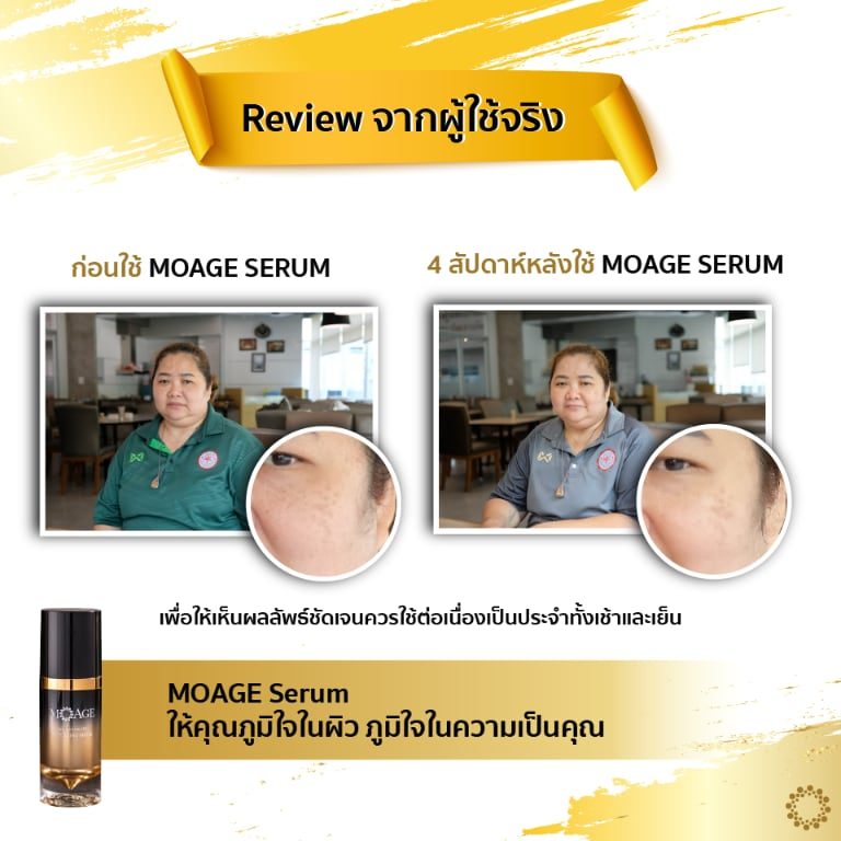 before-after-01