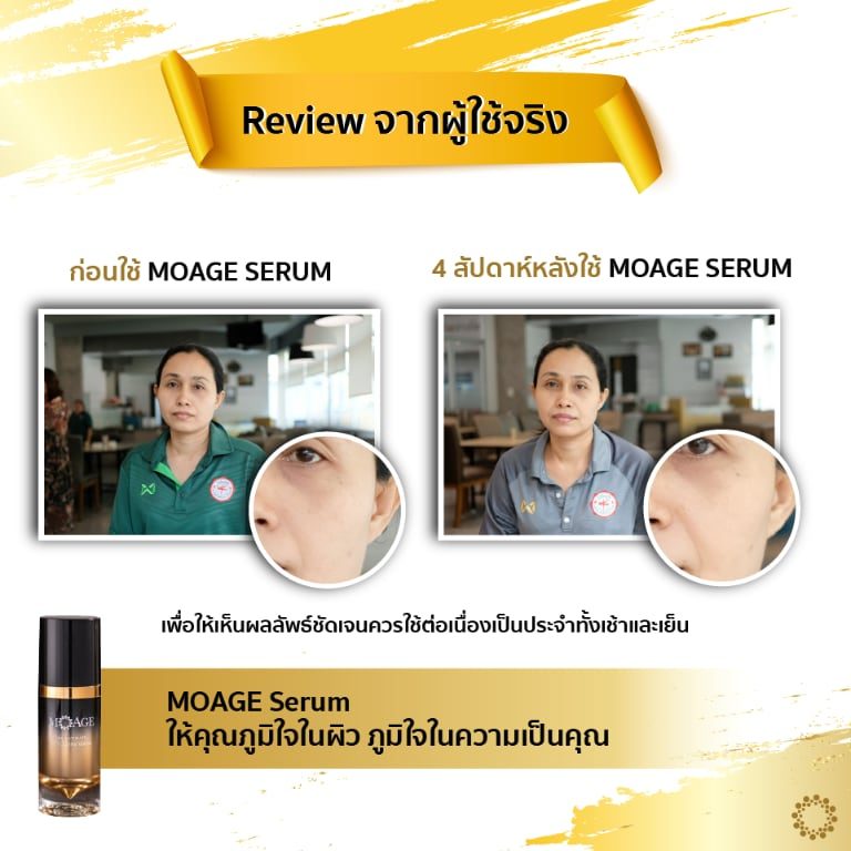 before-after-02