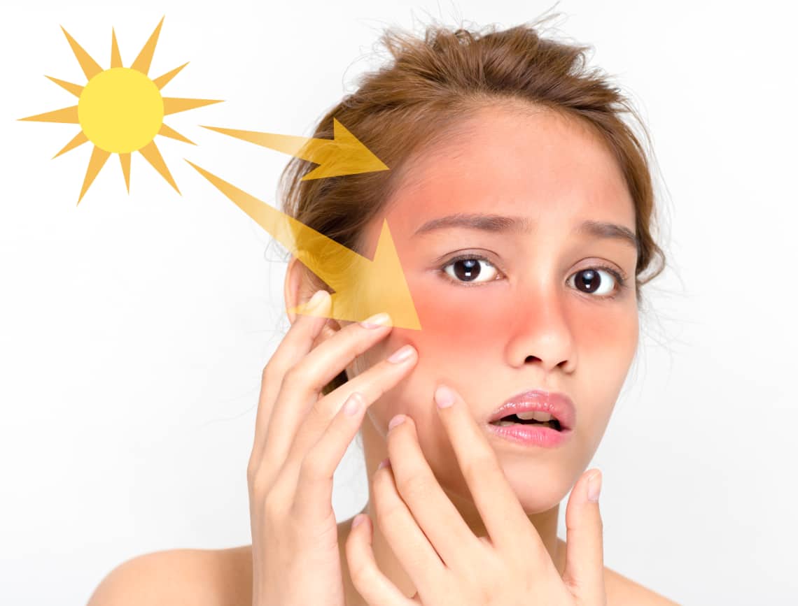 avoid allergic things